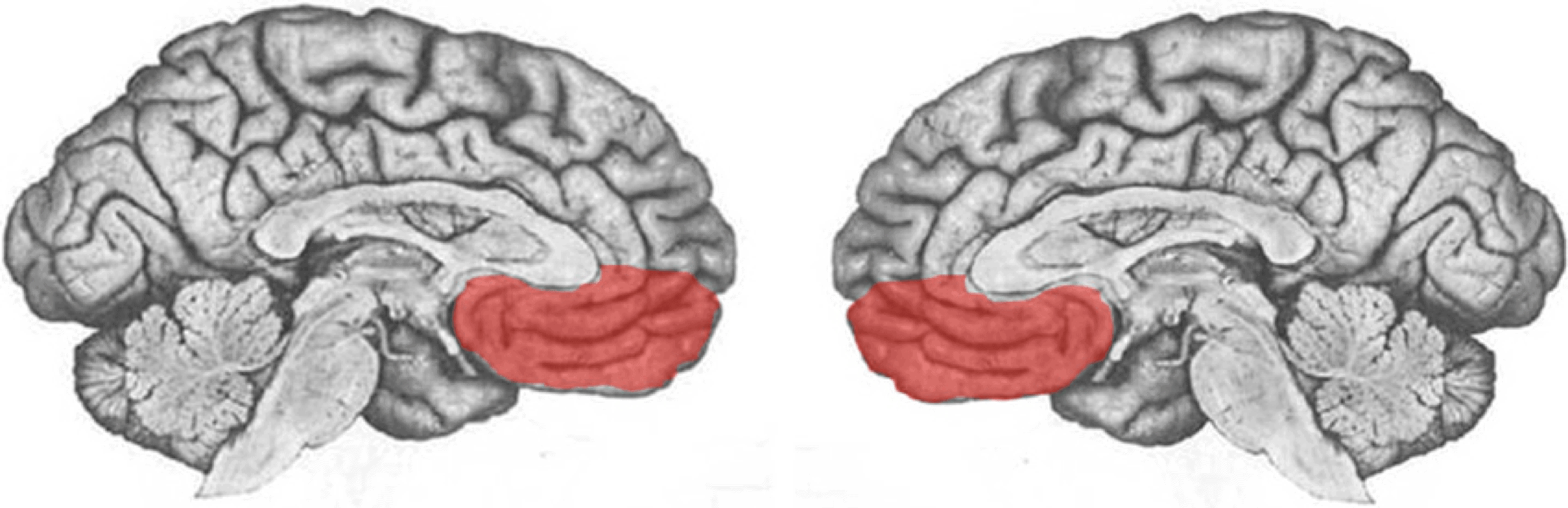 Ventromedial prefrontal cortex