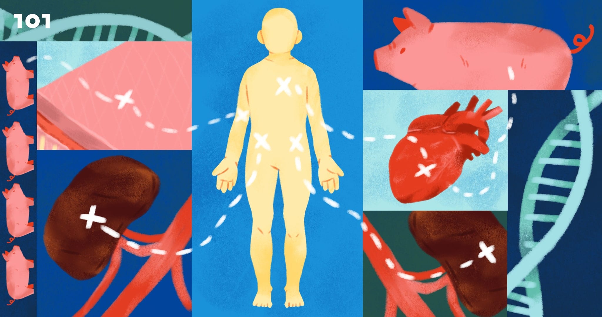 'อวัยวะหมู' สู่ 'ร่างกายมนุษย์' : การปลูกถ่ายอวัยวะที่อาจเกิดขึ้นในปีนี้